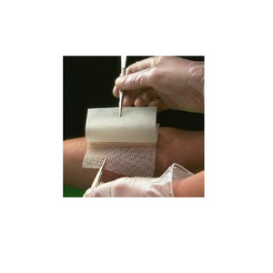 Impregnated Gauze