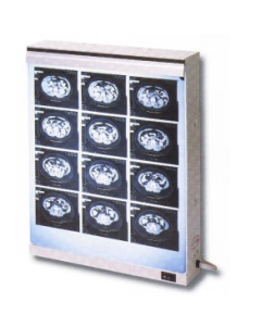 X-Ray Viewer 14" x 17"