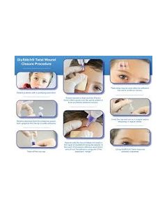 GluStitch®, 0.2mL, Violet