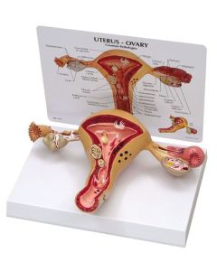 Uterus Model