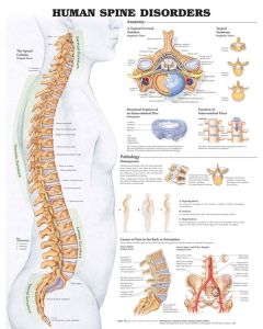 Human Spine Disorders Poster