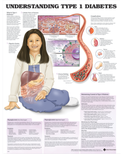 Understanding Type 1 Diabetes Poster