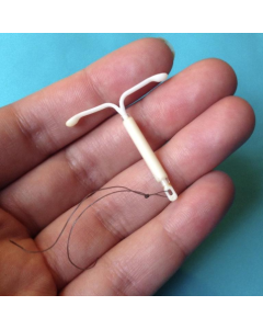 Mirena® IUD